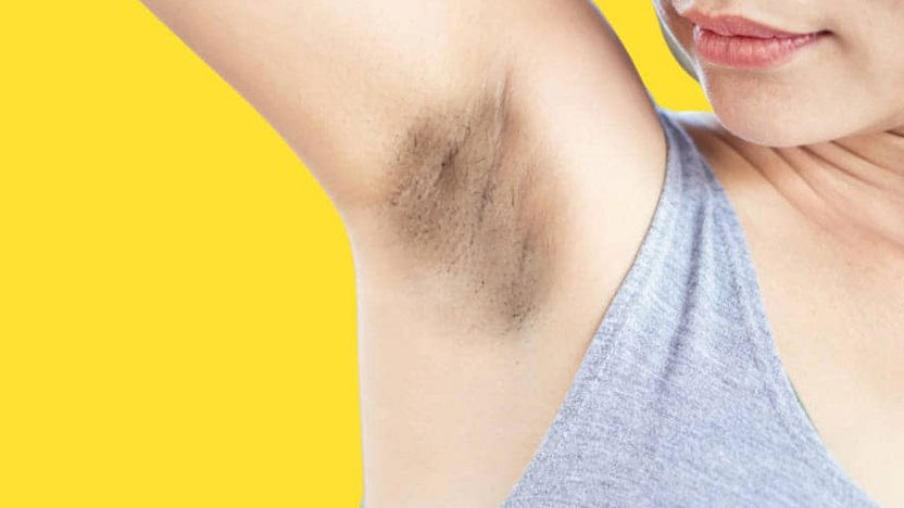 Dark underarms remedies