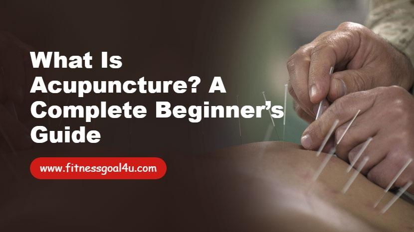 What Is Acupuncture? A Complete Beginner Guide