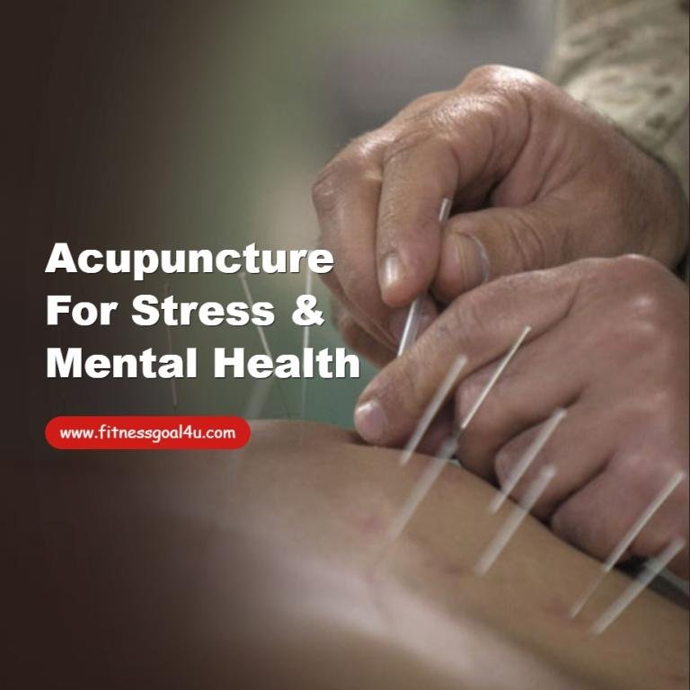 Acupuncture for Stress & Mental Health