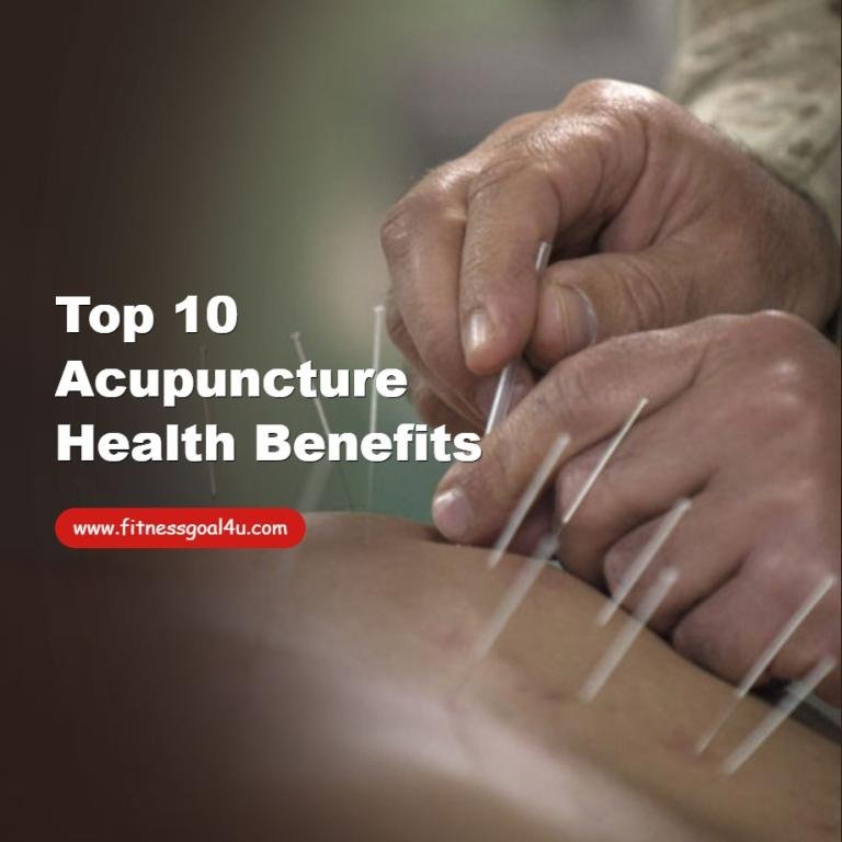 Top 10 Acupuncture Health Benefits