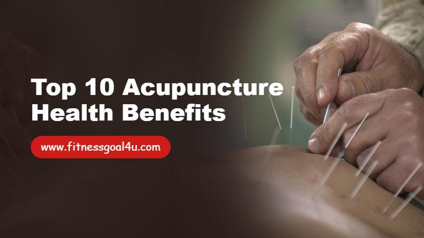 Top 10 Acupuncture Health Benefits